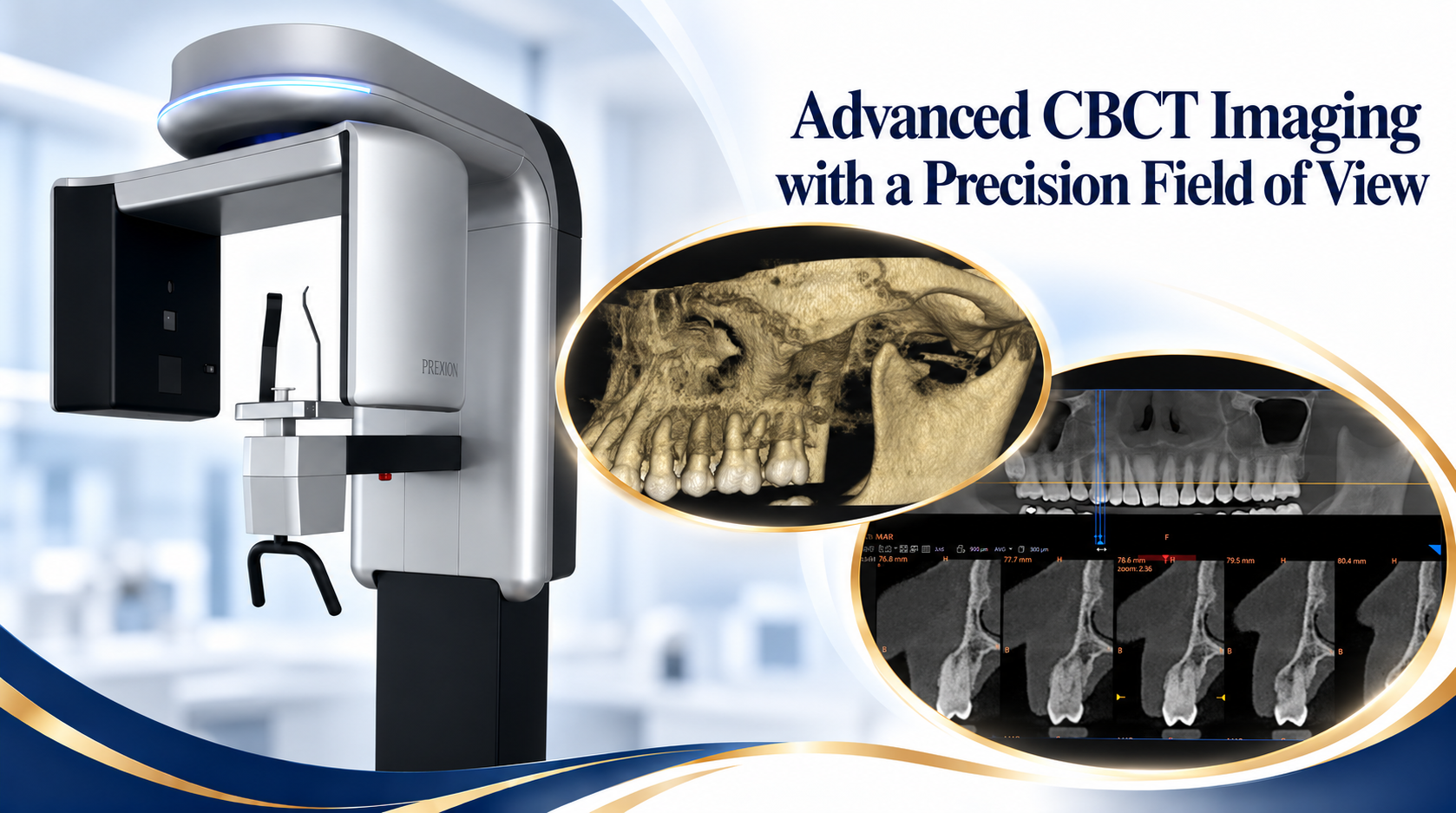 Cone beam CT imaging equipment and 3D dental scan examples.