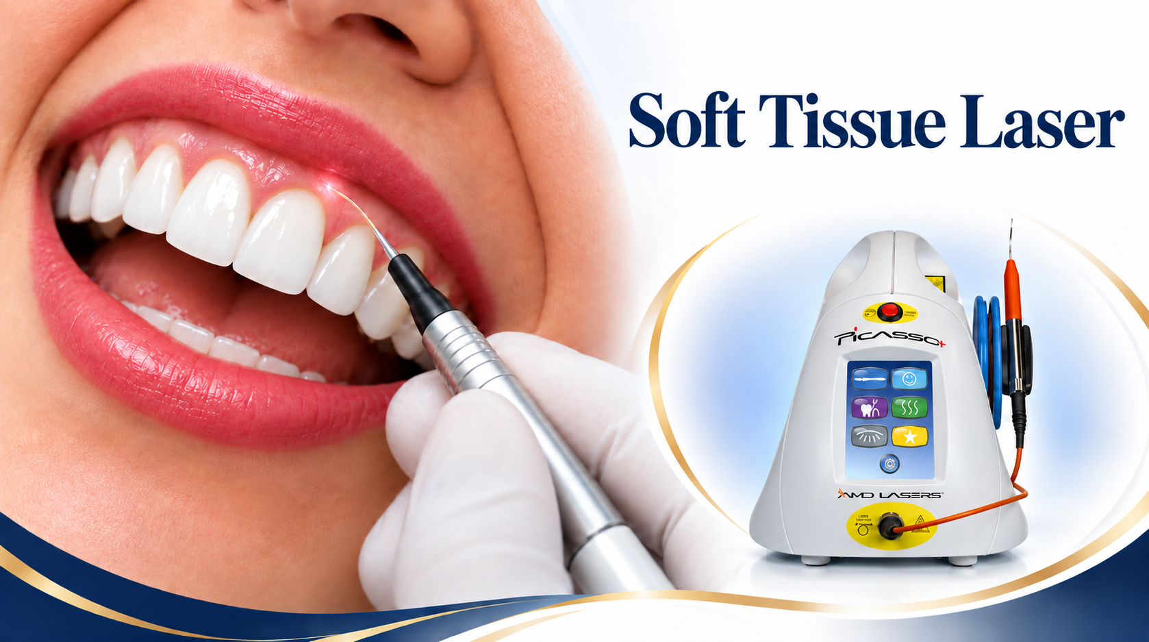 Dental laser technology shown during soft tissue treatment.